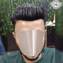 After hair replacement