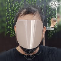 Before hair replacement