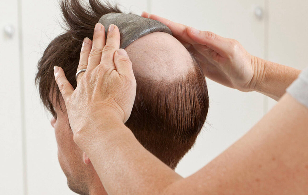 Non Surgical Treatments